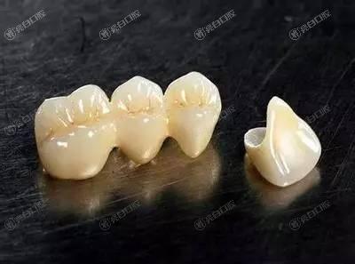 杭州烤瓷牙哪家医院好？曝靠谱技术好的烤瓷牙前十口腔医院