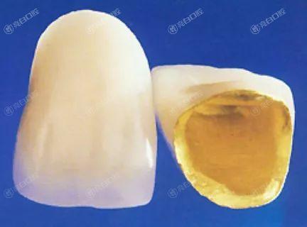 北京烤瓷牙纳入医保了吗？2025北京烤瓷牙服务好的医院排名曝光