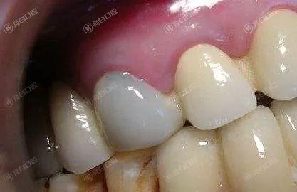 成都烤瓷牙哪家医院好？曝评分高、技术好的十大口腔医院