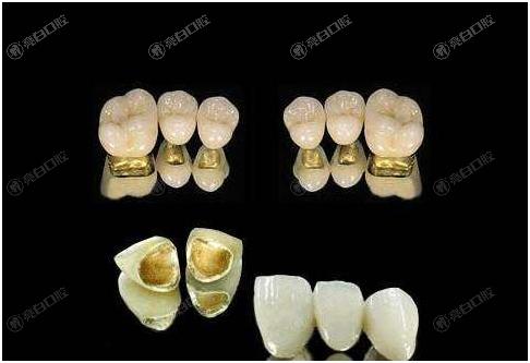 2025年深圳哪里烤瓷牙效果好又不贵?这份深圳口腔医院排名前十强烈推荐