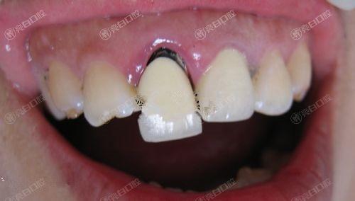 北京烤瓷牙到哪个医院好？这十大口腔医院靠谱环境好