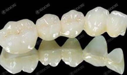 南充烤瓷牙哪家医院好？曝评分高、价格好的四大口腔医院