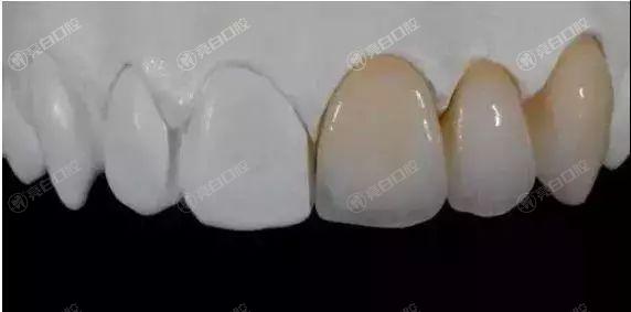 上海全瓷牙哪里靠谱服务好？速览这十家正规服务靠谱的口腔医院