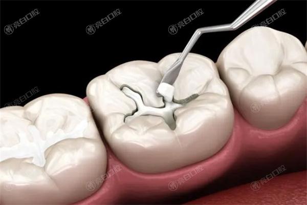沈阳纽大口腔门诊部价目表
