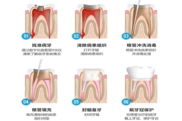 深圳穗华口腔医院价格表