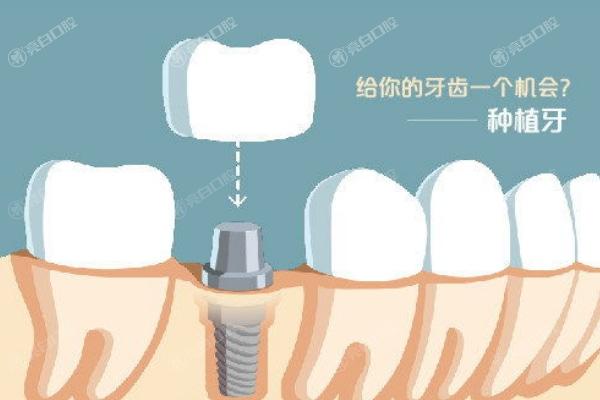 郑州口腔医院排名前十及价格表更新 这几家种牙/拔牙/矫牙/假牙不贵可冲！