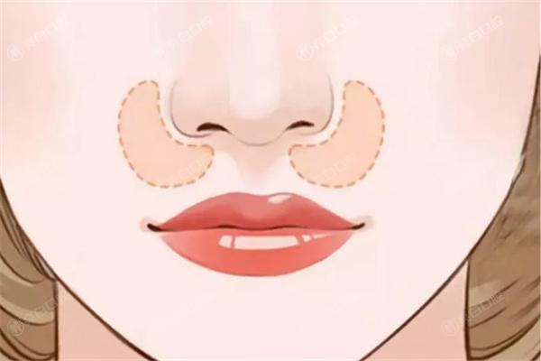 上海妈生鼻口碑好的医生及价格:范荣杰/李健做自然妈生鼻子尤其出名