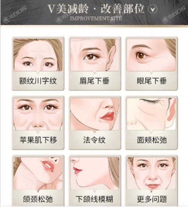 北京加减美整形医院的v6价格5万起！黄寅守/穆宝安/范惟不同医生v6价格也不同