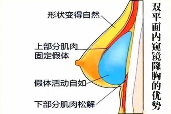 殷初阳医生隆胸价格5w起!做隆胸/韧带提升等技术出名附详细预约方式和坐诊地址
