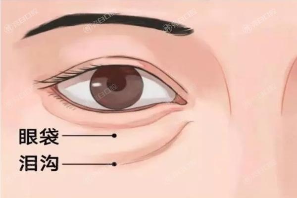 贺洁医生眼整形价格表2025:修复眼袋/卧蚕/下眼睑/双眼皮等费用一览
