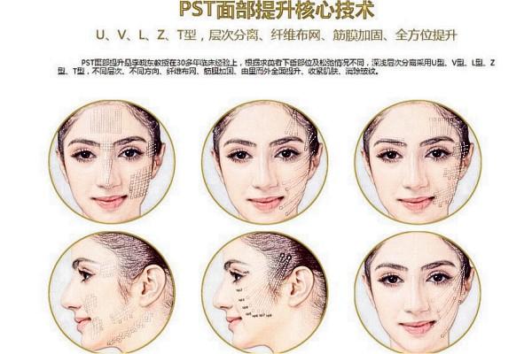 2025去韩国整形大概多少钱?隆胸/隆鼻/修复/吸脂等价格表分享