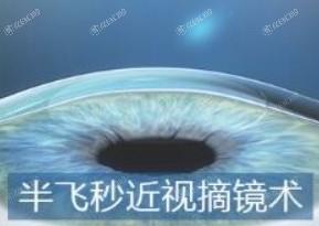 惠州希玛眼科是不是正规的 正规靠谱医院不坑人