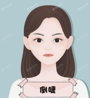 北京眼皮下垂矫正哪个医院好？ 美可儿/黄寺/成好技术牛口碑好