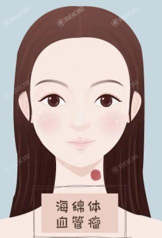 长沙吸脂瘦手臂正规医美医院排名公布 口碑好又正规的医美诊所