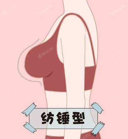 石家庄男士女乳症整形医院哪家好 石家庄天宏医疗美容医院、创美和石家庄芘丽芙贵美人医疗美容医院都是口碑公认