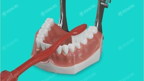 做完牙周治疗术后能立即服用布洛芬止痛吗?