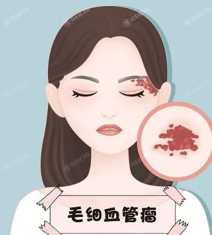 北京注射整形有名的整形医院排名 排名靠前的禾美嘉