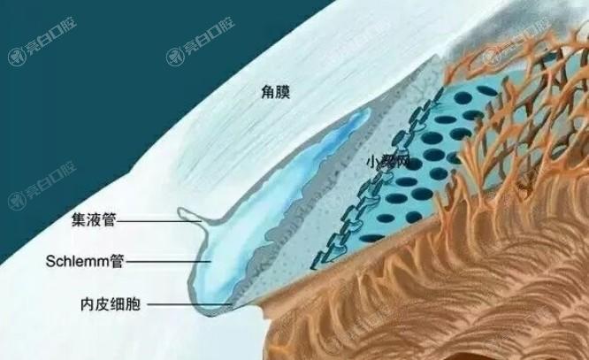 做散光晶体手术全过程实拍,解析术后恢复期