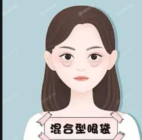 厦门假体peek丰额头哪家正规又靠谱？ 汇总厦门假体peek丰额头便宜又好的医院医生 