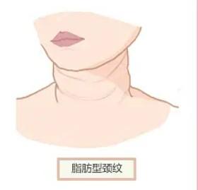 济南酷雪翠绿宝石激光脱毛有名的整形医院名单公布  告诉你哪里做酷雪翠绿宝石激光脱毛技术更好！
