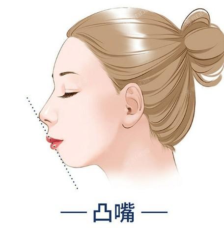 洛阳乳头飘色4大排名榜已上线 洛阳华美医疗美容、西工莱尔美、毛大夫整形都在榜