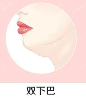 东莞莞城美立方医美口腔医院可靠吗 医生口碑真不错