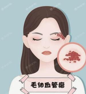 长沙光子嫩肤哪个医院好？ 一并看看长沙哪家医院好