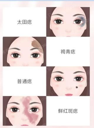 南京卧蚕便宜又好的医院有哪些 听说美莱、维多利亚、华美正规口碑好