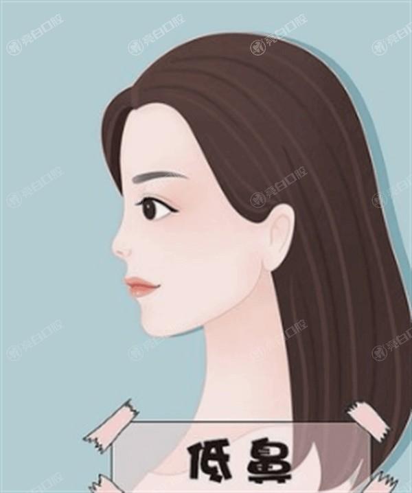 天津下眼睑下至术哪个整形医院好？ 排名上博莱美/爱丽诺/美莱挺出名