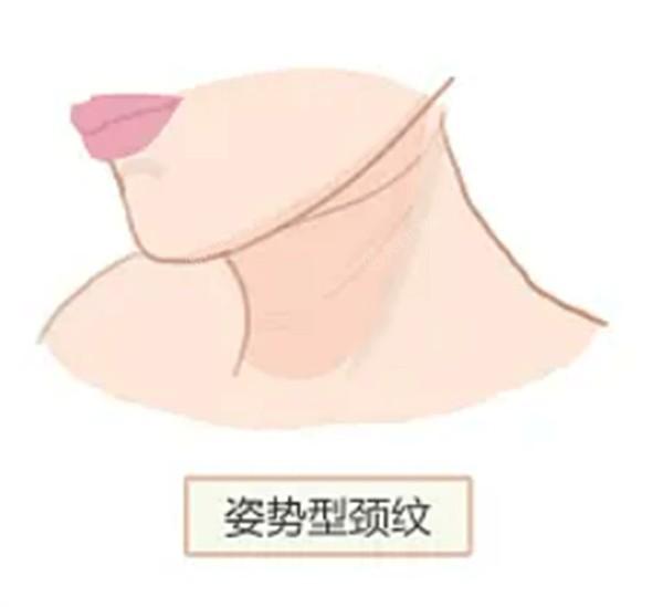常州微雕点阵王哪个整形医院可以做 常州有名的是友谊、美贝尔整形、施尔美