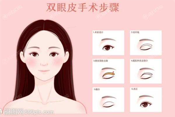 太原眼底脂肪重置去黑眼圈哪家正规又靠谱？ 有名的是华晋医院/华美/太原军大医疗美容医院