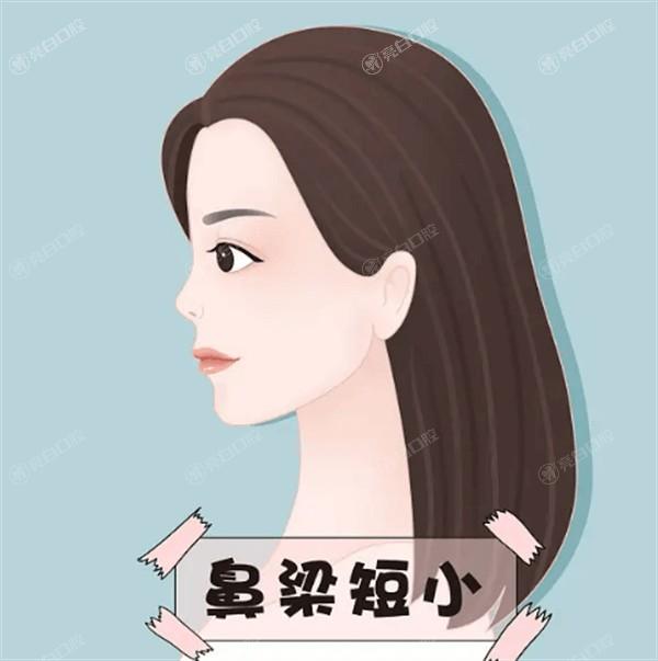 大连鹰钩鼻矫正整形医院排名 排名上爱德丽格/大连沙医生整形/大连美天医疗美容医院挺出名