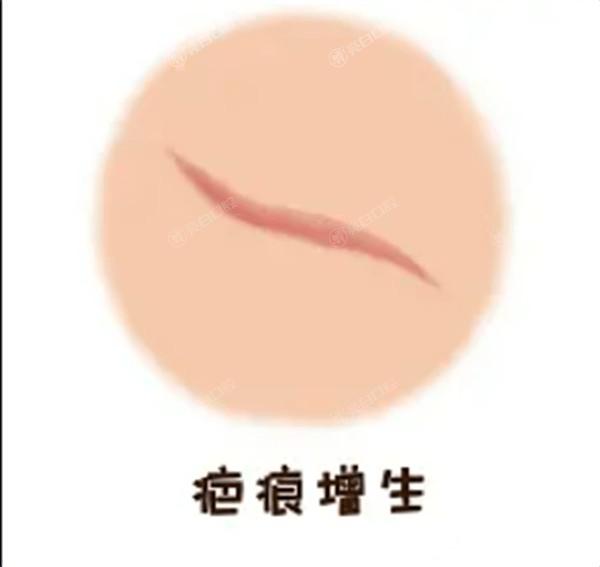 桂林吸脂瘦小腿4大排名榜已上线 星范、时光收费不高技术好