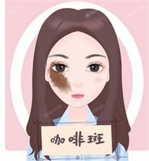 武汉定点双眼皮排名好的整形医院名单 美莱/武汉美莱整形医院/武汉艺星医疗美容门诊部技术牛口碑好