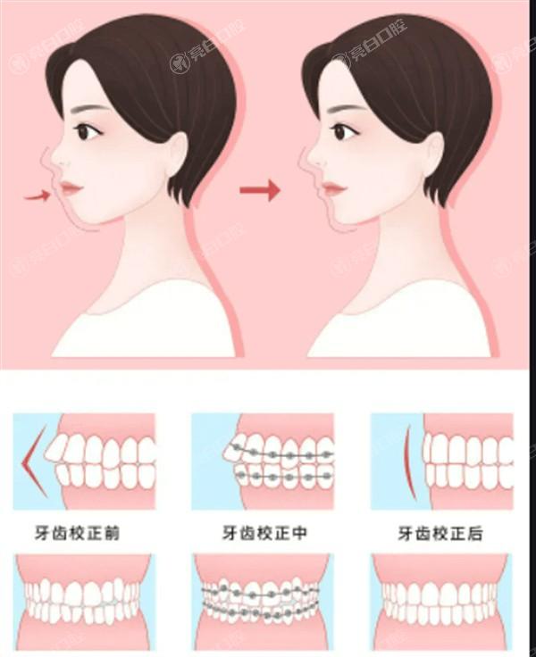 长沙欣德美玻尿酸排名前8公布 这些均是正规的整形医院价格不贵