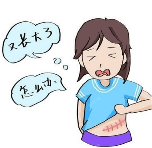 重庆斜颈矫正手术好的医院排名 这些均是正规的整形医院价格不贵