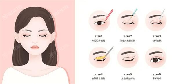 广州水光补水哪个整形医院可以做 广州美莱医疗美容/广大/广州高尚医疗美容均在榜单