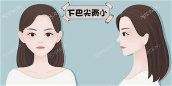 青岛玻尿酸丰太阳穴哪个整形医院可以做 知颜智妍/青岛诺德医学美容医院/壹美天成做玻尿酸丰太阳穴比较好 