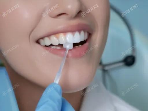 北京中老年种牙去哪好?立得用技术当天戴牙省时省心医生团队坐诊收费透明