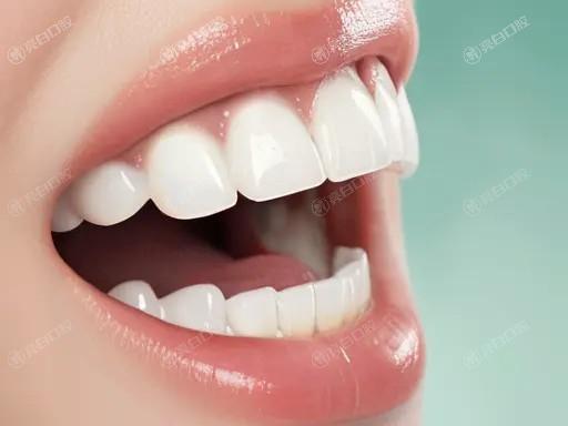 做美加易齐隐形微矫正前需要准备什么？这几个要点你一定要知道！