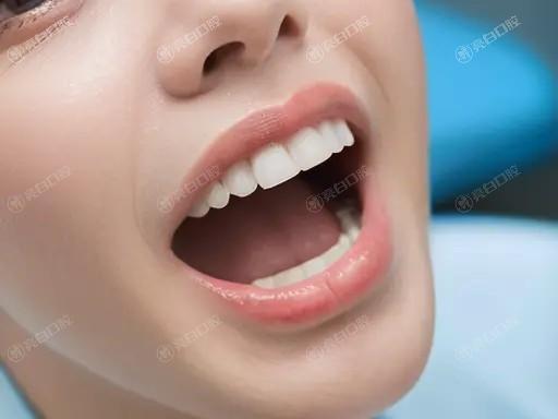 做预成冠前有什么忌口的？这些事项你一定要知道，别忽视了！