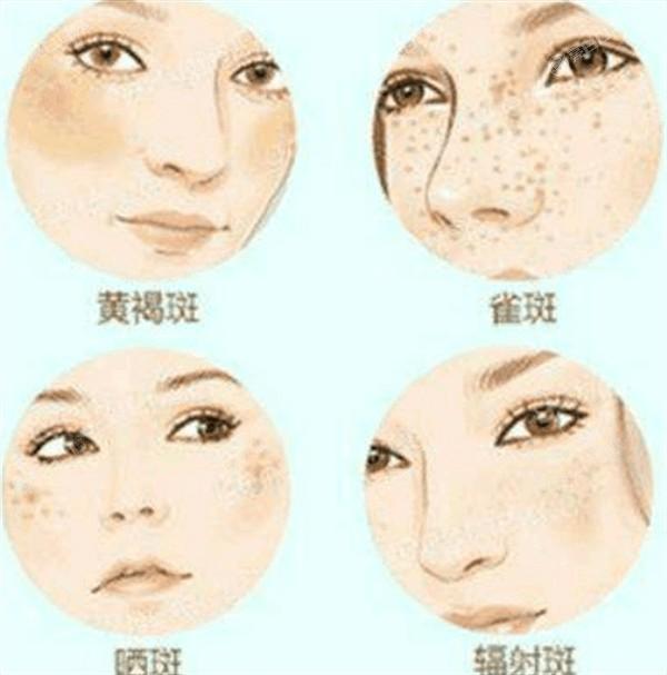 苏州宽鼻矫正比较好的整形医院 来看哪些医院技术好又实惠