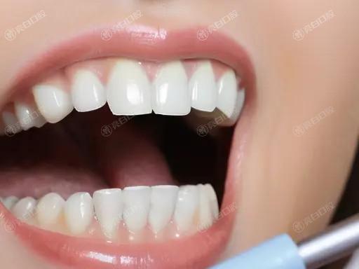 安排常州牙科的医院贴面价格一览表 超薄瓷贴面/树脂贴面//费用不贵