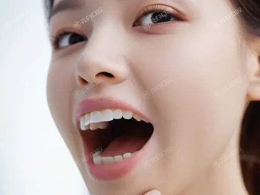 揭秘深圳牙科的医院牙齿美白价格一览表 3D锆齿美白100+冷光美白2000+洗牙300+