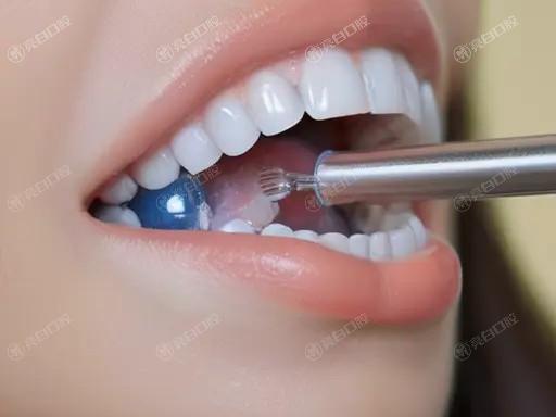 做欧睛自锁托槽后，能否快速上班，工作生活不受影响？