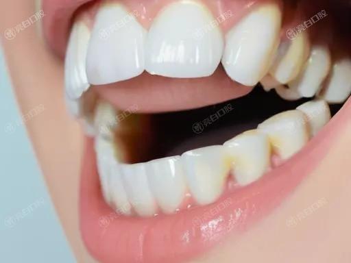 做悦美氧化锆的过程会疼吗？揭秘牙齿美白背后的真实体验与感受！
