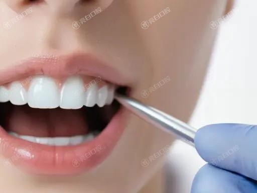 做楔状缺损充填前可以喝酒吗？了解这些注意事项，确保口腔健康！