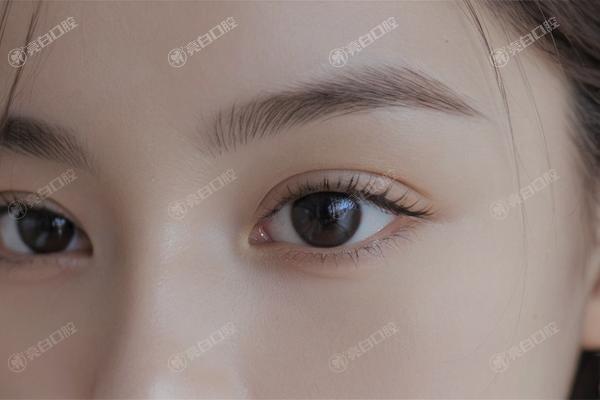 深圳奥美定取出哪家整形医院正规便宜? 