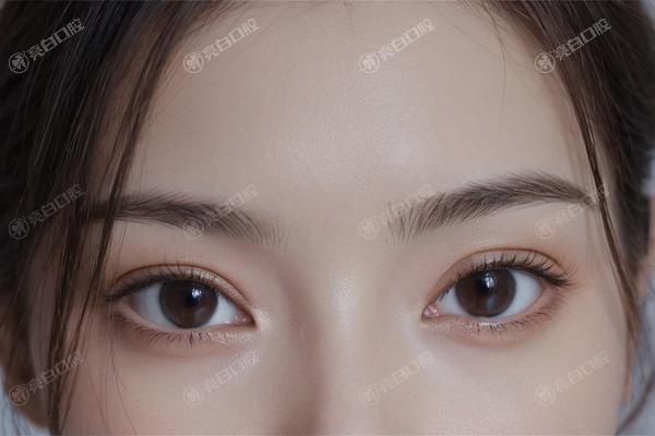 天津三重埋线提升整形医院哪家好 博莱美|爱丽诺|美莱都是正规整形放心选