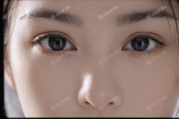乌鲁木齐舒颜玻尿酸整形医院哪个好 新疆整形美容/王共礼/青松星范均在榜单